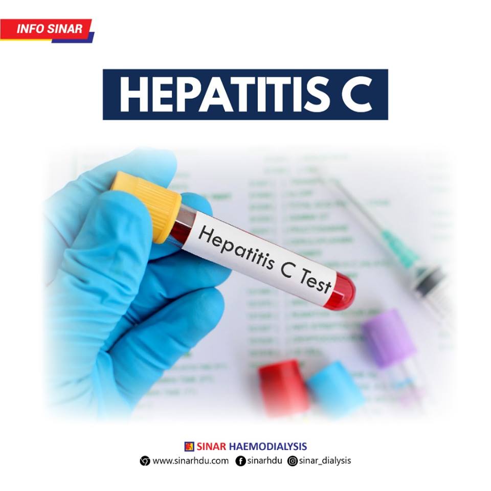 HEPATITIS C: APA YANG ANDA PERLU TAHU?